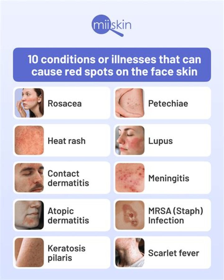 Can STD cause red spots?