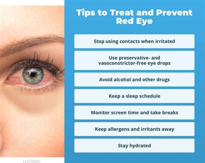 How do you prevent red eyes when high?
